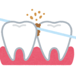 フロスで磨いている